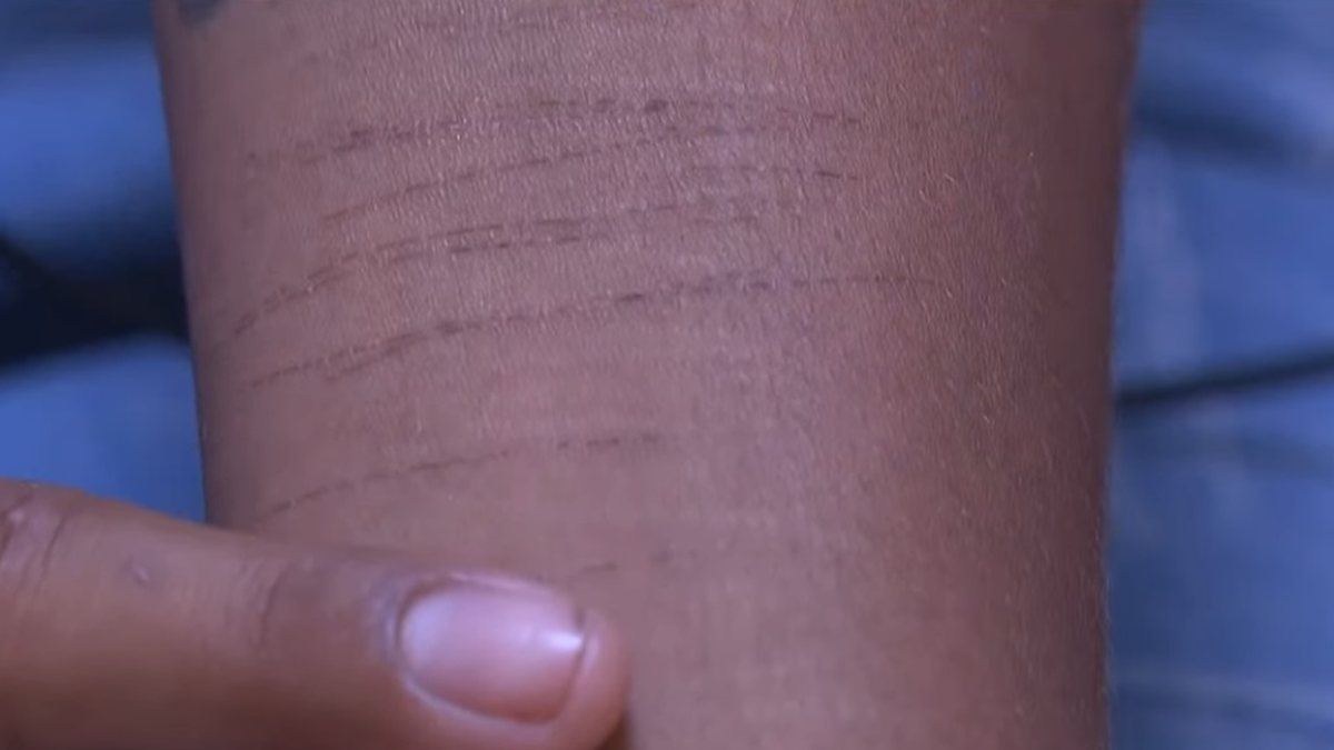 Crime Brutal em Rio Largo: Estupro Coletivo Choca Alagoas e Exige Respostas Urgentes
